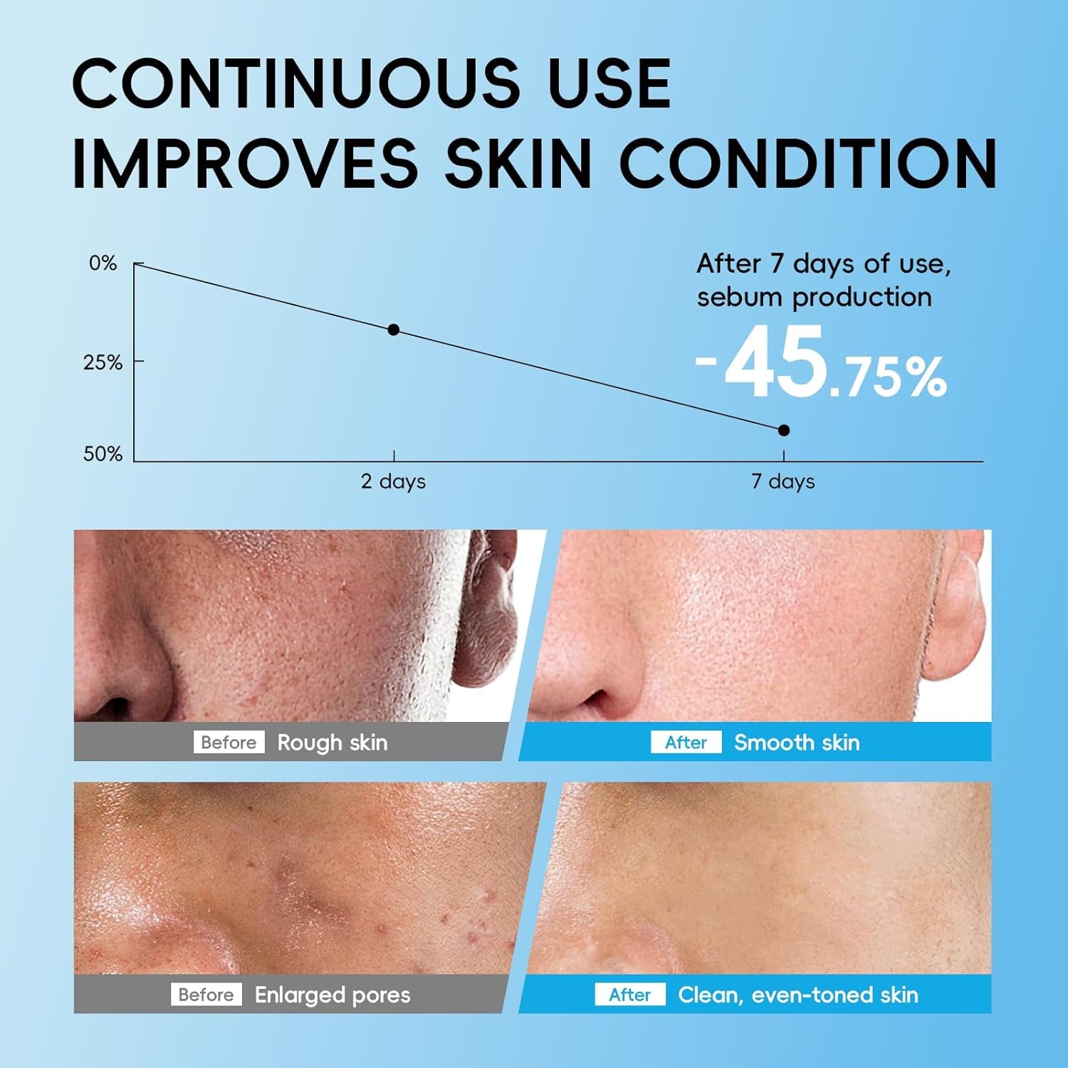 Kit De Soins Visage Homme - Routine Hydratante Complète 3 Pièces Avec Nettoyant, Lotion, Crème - Pour Tous Types De Peau (5 Pcs)